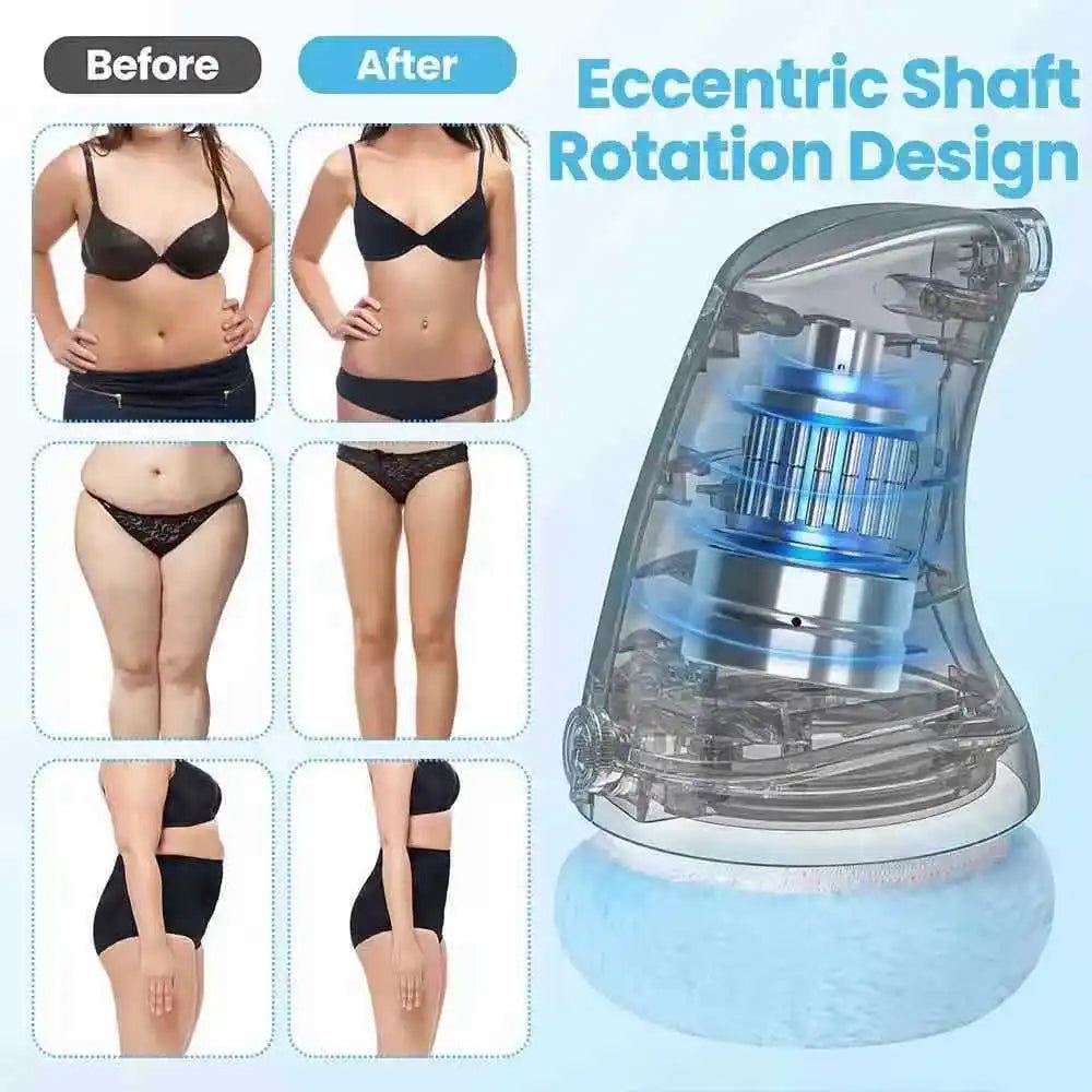 Electric Cellulite & Body Sculpting Massager — The Wellness Edit by Cassidy Collective