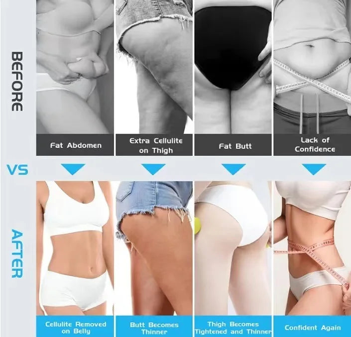 Electric Cellulite & Body Sculpting Massager — The Wellness Edit by Cassidy Collective