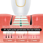 IPL Laser Hair Removal Device