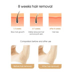 IPL Laser Hair Removal Device