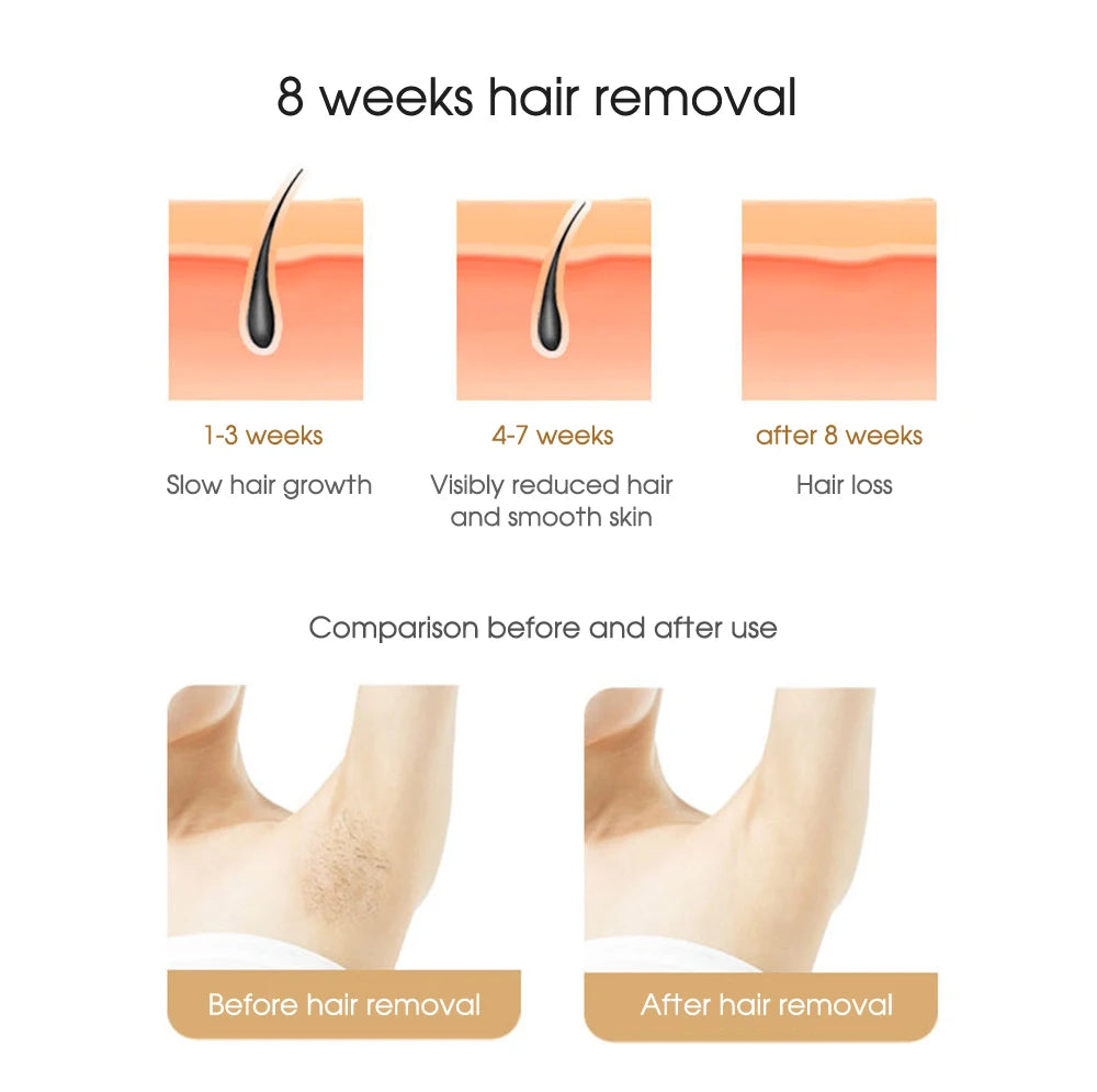 IPL Laser Hair Removal Device — The Wellness Edit by Cassidy Collective